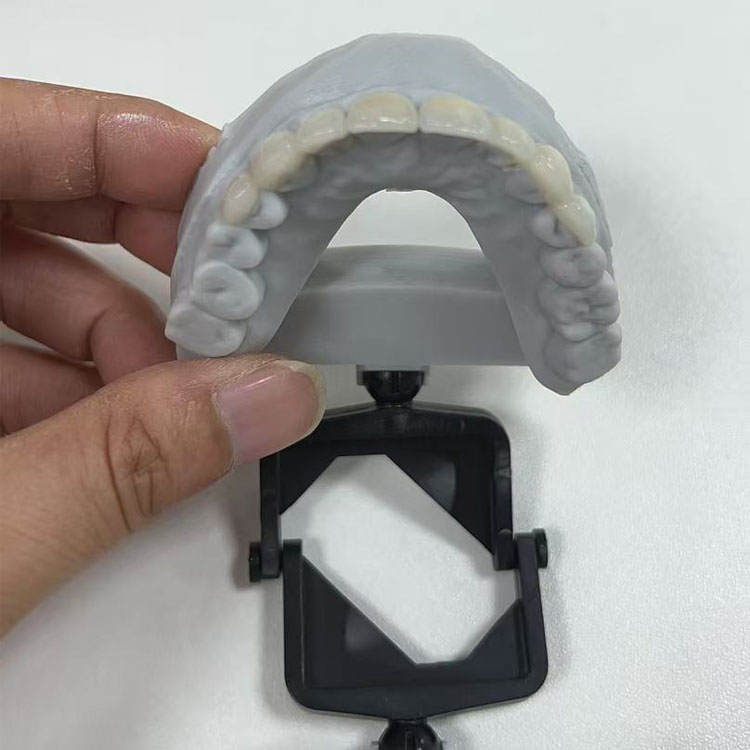 emax dental 1