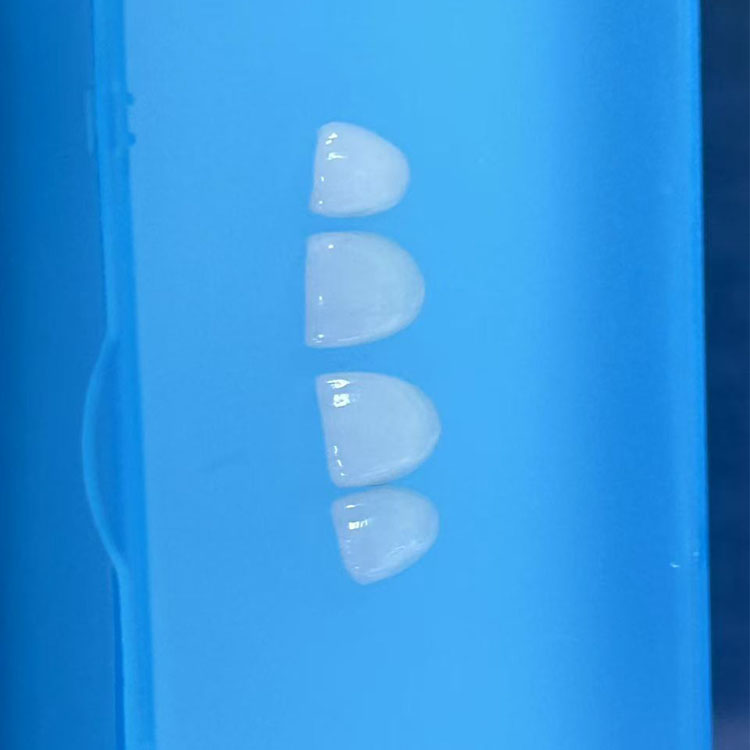 emax dental 3