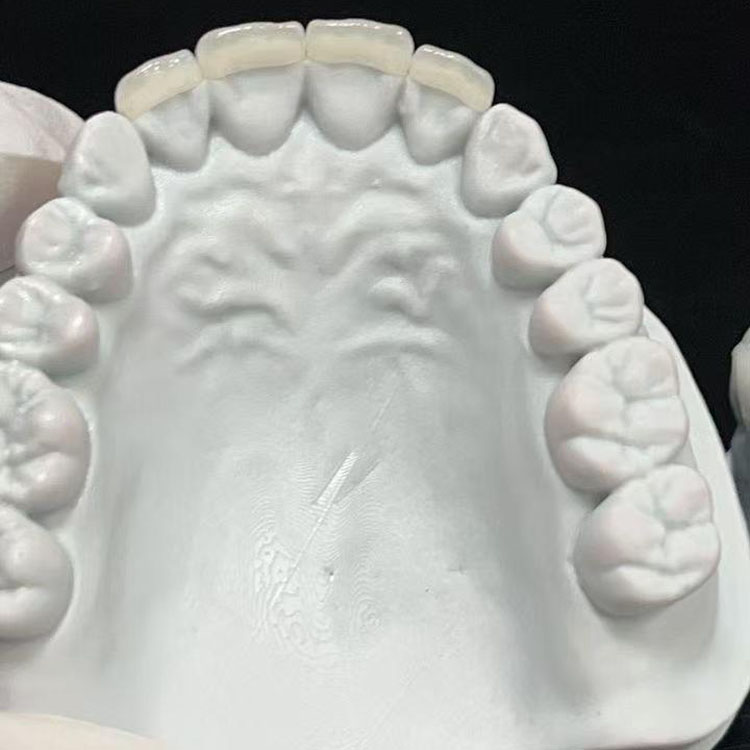 emax dental 6